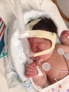 Talynn a couple days old in the NICU. 